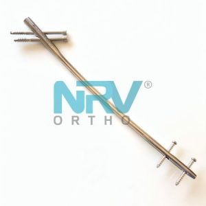 N AFFIX PROXIMAL FEMORAL NAIL – LONG