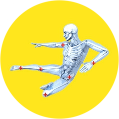 N-Fix Cortical Screw